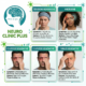 headache specialist in delhi