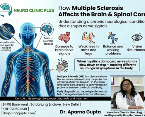 Multiple Sclerosis