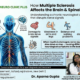 Multiple Sclerosis
