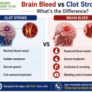 brain specialist in Delhi