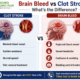 brain specialist in Delhi