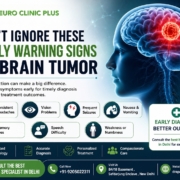 best brain specialist in delhi