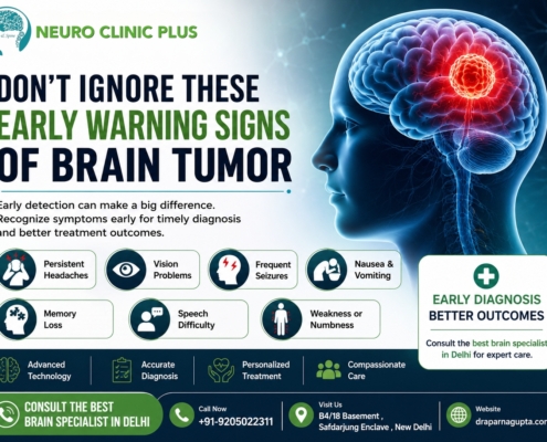 best brain specialist in delhi