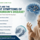 best parkinson's specialist in safdarjung
