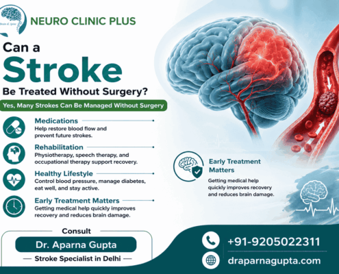 best stroke specialist in delhi